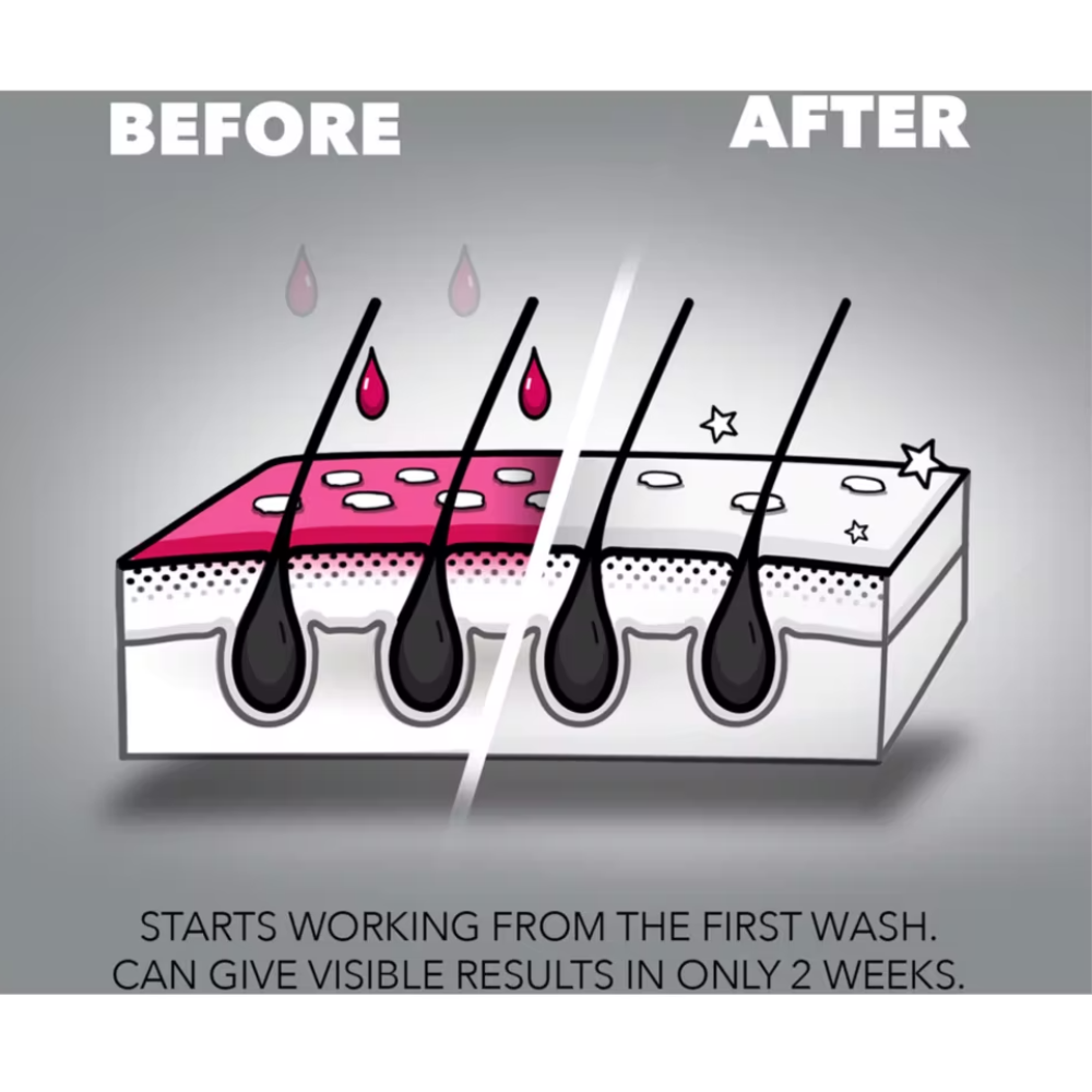 Nizoral®, Dandruff Shampoo 100ml