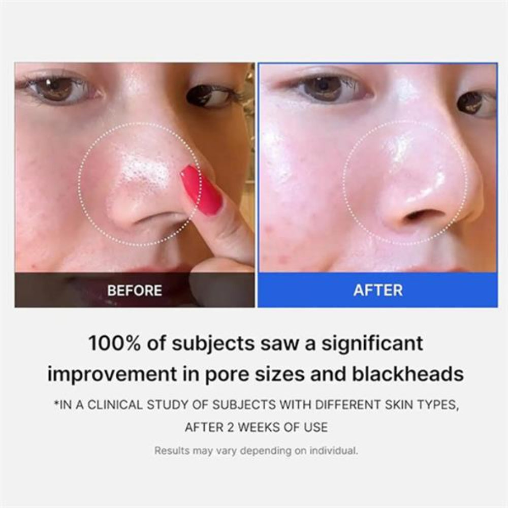 Medicube, Zero Pore Pad 70 Pads