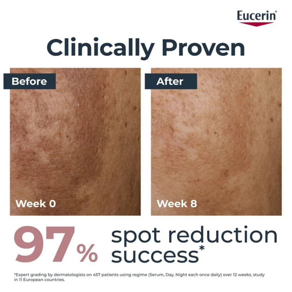 Eucerin®, Anti-Pigment Day SPF30 Cream 50ml